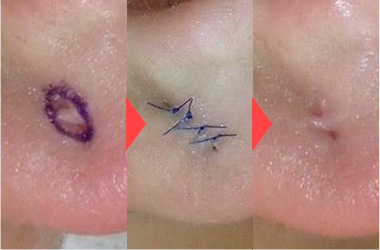 ピアス穴径1-2mm