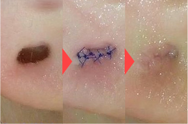 ピアス穴径3-9mm