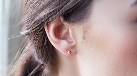 炭酸ガス（CO2）フラクショナルレーザーについて