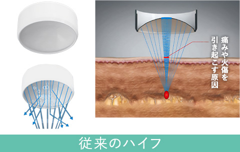 ピーリングの効果